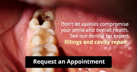 Cavity Repair and Fillings